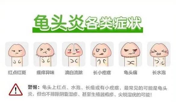 男性下面有异味是什么原因。