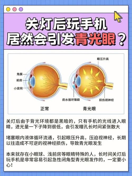 如果晚上经常关灯玩手机,手机屏幕越亮还是越暗好,哪种对眼睛好 家电资讯