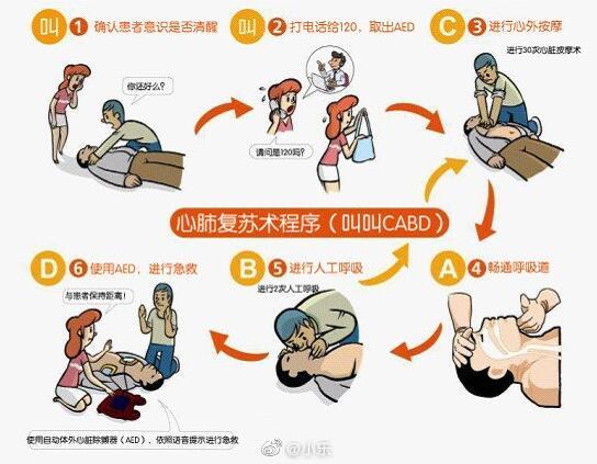 什么情况下会发生“性猝死”。医生行房时的4种行为，务必避免