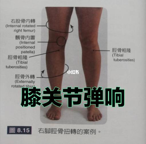 膝盖关节响是什么病引起的_早上起来走路时膝盖咯噔响是怎么回事